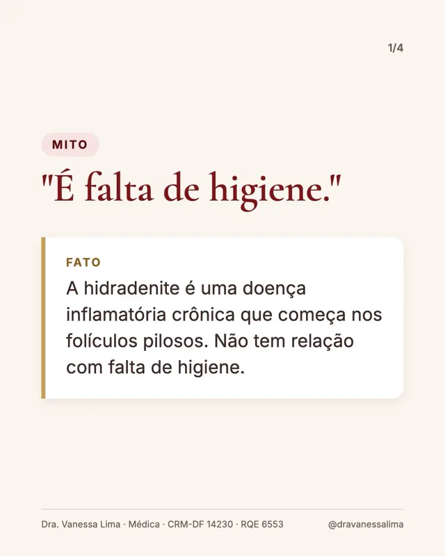Mito 'É falta de higiene.' Fato A hidradenite é uma doença inflamatória crônica que começa nos folículos pilosos. Não tem relação com falta de higiene.