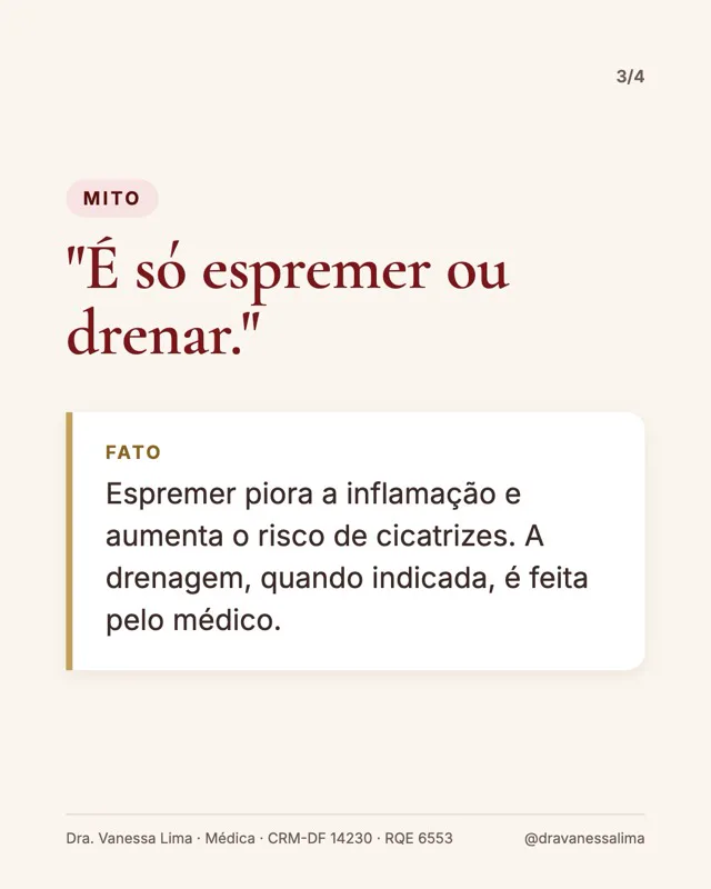 Mito 'É só espremer ou drenar.' Fato Espremer piora a inflamação e aumenta o risco de cicatrizes. A drenagem, quando indicada, é feita pelo médico.