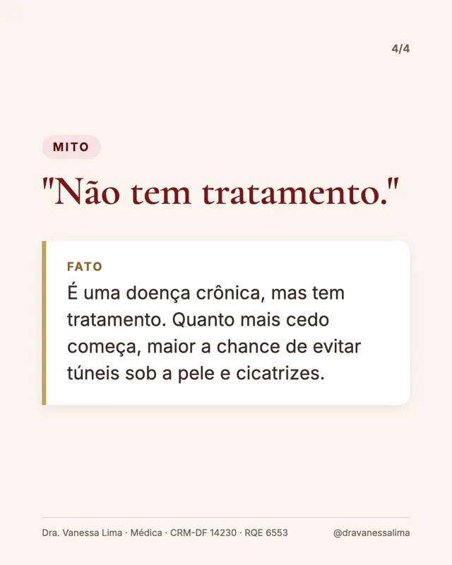 Mito 'Não tem tratamento.' Fato É uma doença crônica, mas tem tratamento. Quanto mais cedo começa, maior a chance de evitar túneis sob a pele e cicatrizes.