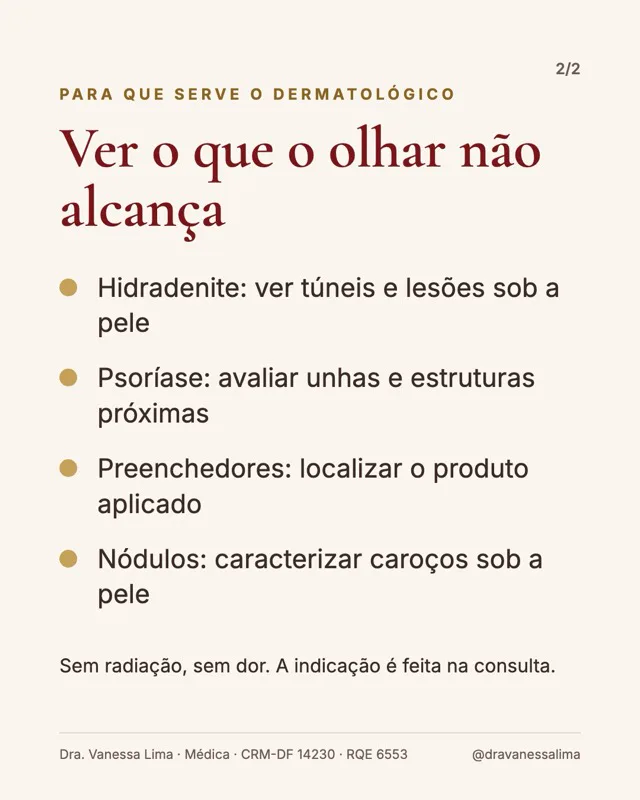 Para que serve o dermatológico Ver o que o olhar não alcança Hidradenite: ver túneis e lesões sob a pele Psoríase: avaliar unhas e estruturas próximas Preenchedores: localizar o produto aplicado Nódulos: caracterizar caroços sob a pele Sem radiação, sem dor. A indicação é feita na consulta.